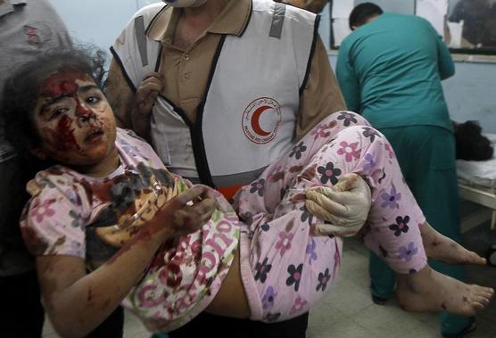 Medico palestino sostiene a una niña herida en uno de los improvisados hospitales de Gaza