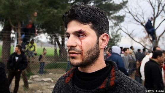 Migrante en busca de asilo en Europa herido por policías macedonios en la frontera greco-macedonia