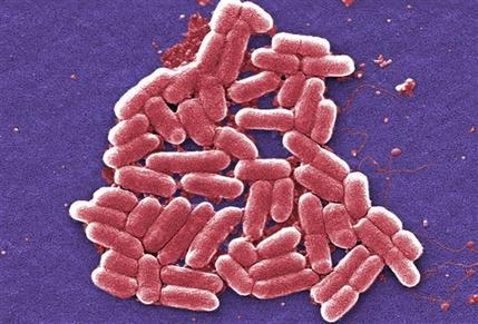 Mmuestra de la cepa O157:H7 de la bacteria E. coli.