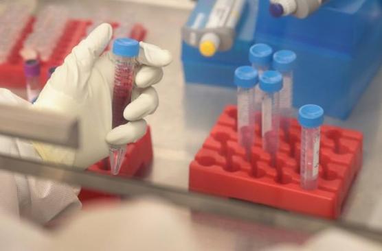 Muestras con sangre de monas embarazadas infectadas con el virus del zika en un laboratorio en la Universidad de Wisconsin