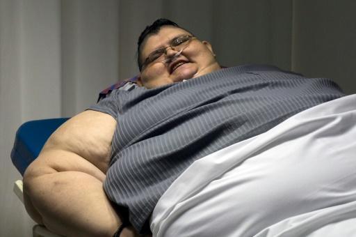 El mexicano Juan Pedro Franco, considerado el hombre más obeso del mundo,