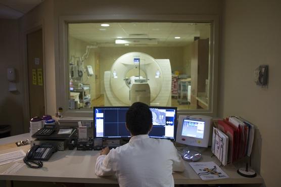 Tomagrafias PET para que la depresión acelera el deterioro del cerebro de los ancianos